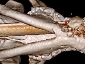 Common Tumors and Tumor-Like Lesions