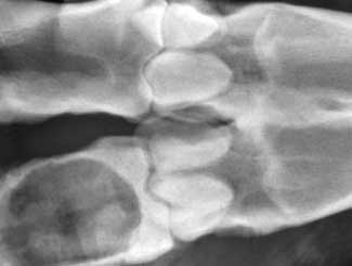 B4 - Bovine: Osteomyelitis