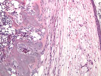 DMA1 - Budgerigar: Ossifying Myelolipoma