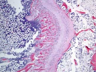 DML14 - Squirrel: Osteoporosis