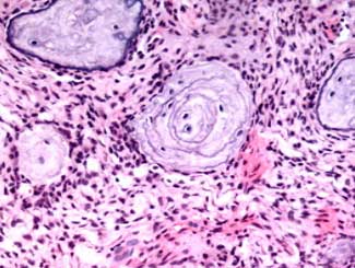 DML9 - Rabbit: Psammotoid Fibroma