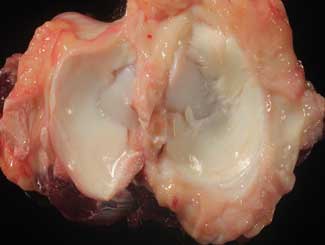 Eq17 - Equine: Osteochondritis Dissecans (OCD)