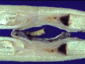 Eq1 - Equine: Superficial Digital Flexor Tendon