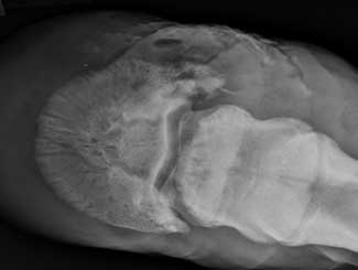 Eq22 - Equine: Navicular Disease