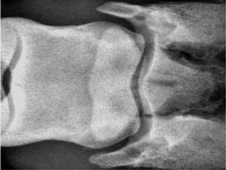 Eq28 - Equine: Navicular Disease
