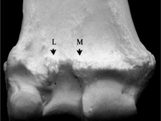 Eq34 - Equine: Physeal Exostosis
