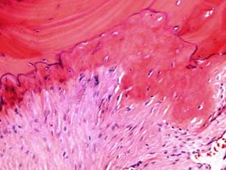 Eq8 - Equine: Enthesophytosis