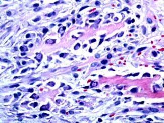 Fe2 - Feline: Carcinosarcoma