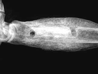 KT11 - Canine: Bone Infarct