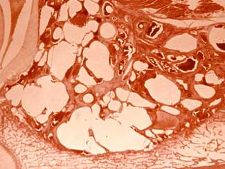 KT2 - Canine: Aneurysmal Bone Cyst