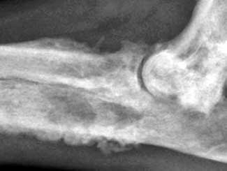 KT26 - Canine: Bone Infarct