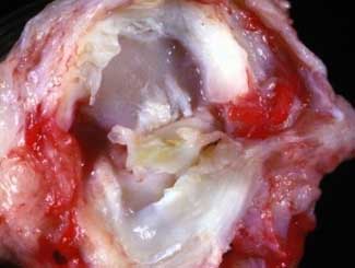 KT47 - Canine: Meniscal Degenerative Disease