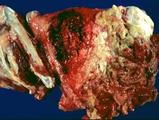 KT64 - Canine: Fibrochondroma