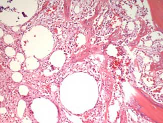 KT95 - Canine: Pleomorphic Sarcoma