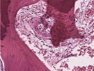 KT98 - Canine: Pleomorphic Sarcoma