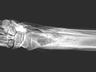 KT10 - Canine: Bone Infarct