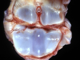 L10: Lecture - Osteochondrosis/OCD, Primarily in Dogs and Horses