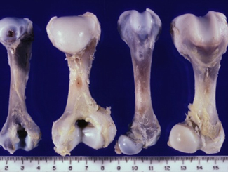 L4: Lecture - Disturbances of Skeletal Development 