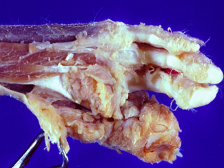 L6C: Lecture - Part 3 of 3, Tumors Joints and Tendon Sheaths