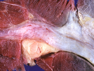 L9: Lecture - Muscle Diseases