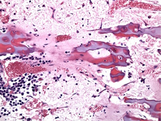 SM16: Seminar - Lead Poisoning, Vitamin D and A Toxicity, Fever Lines