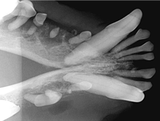 SM17: Seminar - Look-a-Like Jaw and Dental Lesions 