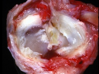 SM2: Seminar - Degenerative Disease of the C-C Ligament and Menisci of Stifle Joint in Dogs