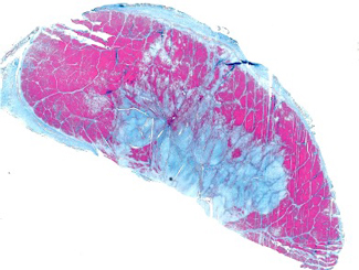 SM24: Seminar - Healing Processes for Bone Fractures, Skeletal Muscle Fibers, and Tendons 