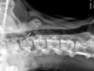 SM6: Seminar - Calcification Periarticular, Tumoral Calcinosis vs Calcinosis Circumscripta