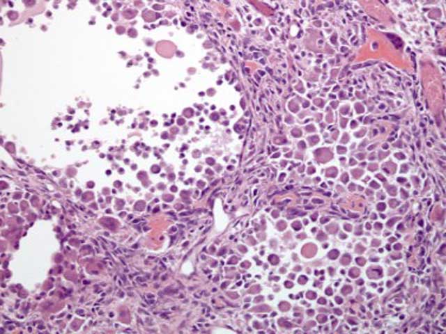 DML4 - Rabbit: Epithelioid Osteosarcoma