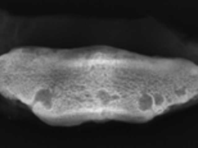 Eq19 - Equine: Navicular Disease