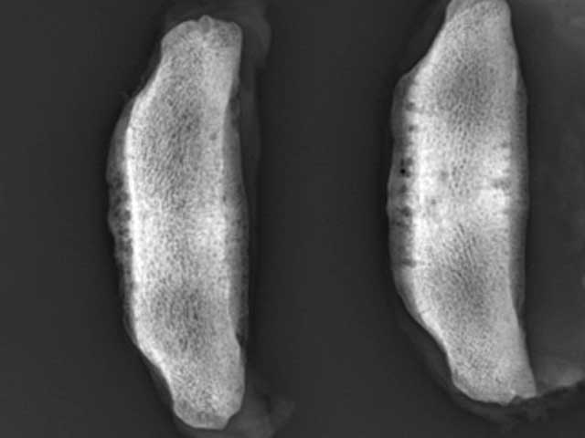 Eq23 - Equine: Navicular Disease