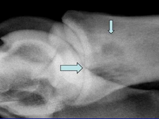 Eq32 - Equine: Osteomyelitis