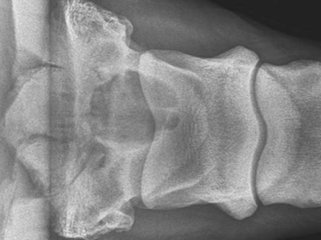 Eq33 - Equine: Cystic Osteomyelitis