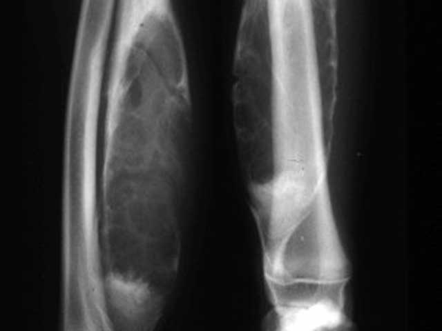 KT51 - Canine: Cystic Bone Lesion