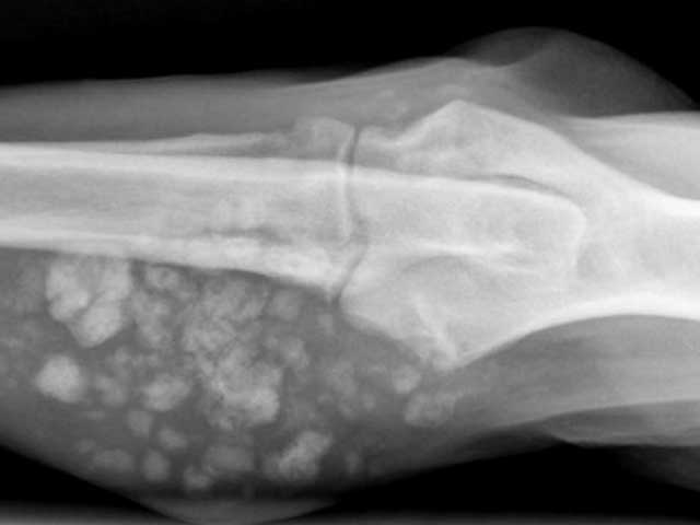 KT58 - Canine: Ectopic Bone Lesion