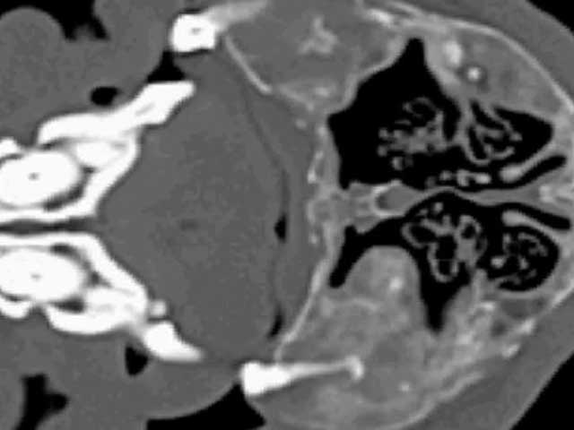 KT66 - Canine: Fibrous Dysplasia Calvarium