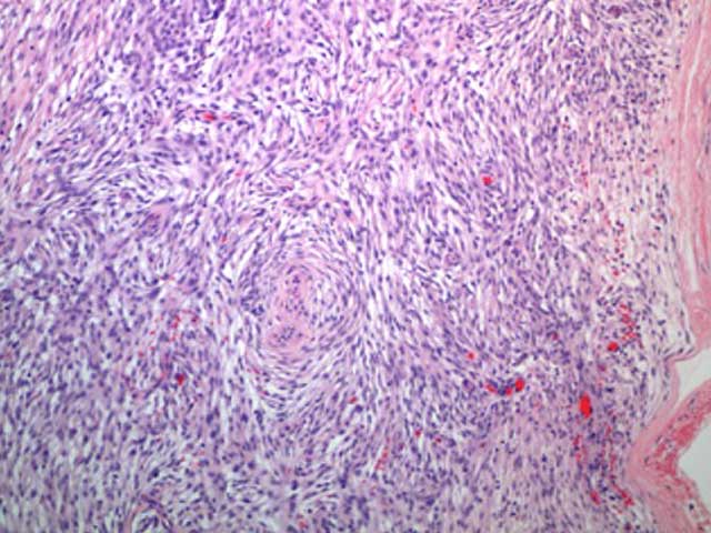 KT68 - Canine: Hemangiopericytoma Perivascular Wall Tumor