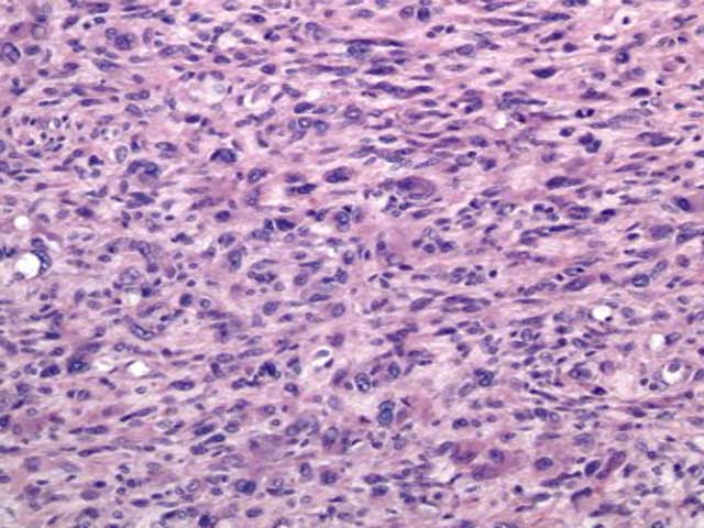 KT97 - Canine: Pleomorphic Sarcoma