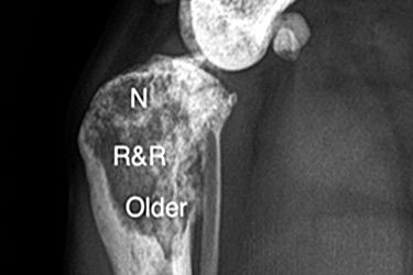 3.1 MSC Skeletal Repair