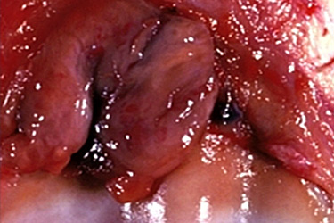 Stem - 8.1 Joint Trauma, Synovial Tumors