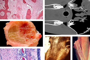 Bone Pathology Slideshow Library