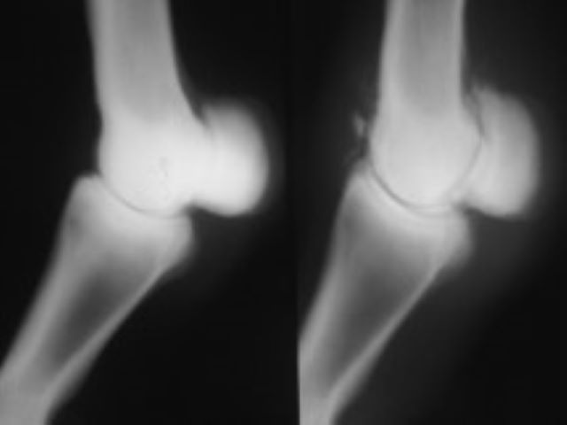 EMP - 10.1 Fetlock Joint Sesamoids