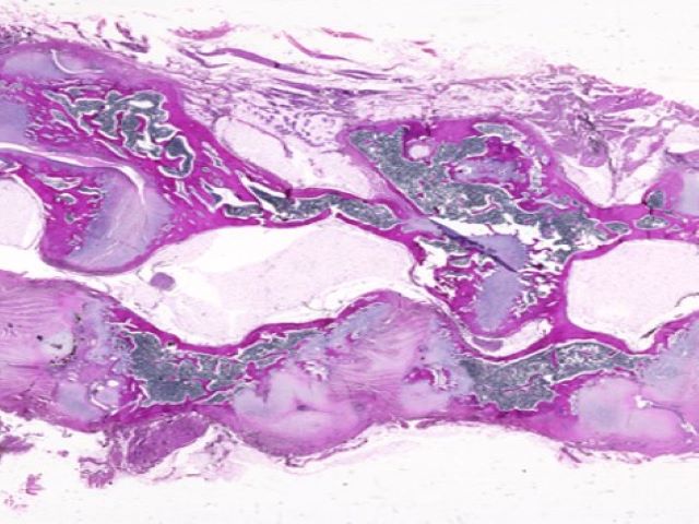 FMP - 12.1 Uncommon Musculoskeletal Disorders