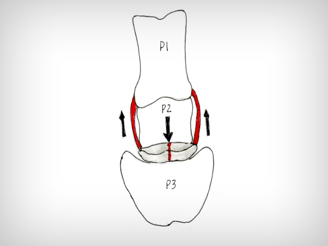 EMP - 13.1 Foot Navicular Anatomy