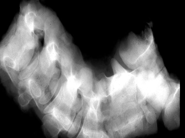 Equine Vertebral Column