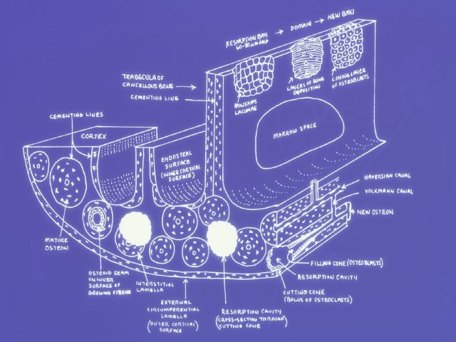 EMP - 4.1 Mechanical Loading Disorders