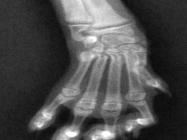 FMP - 6.1 Inflammatory Bone Lesions