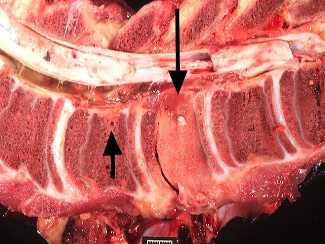 EMP - 2.2 Vertebral Column